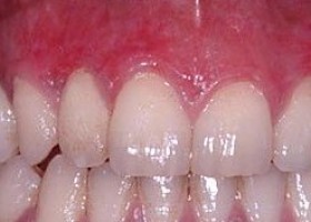 Periodontic Dentistry
