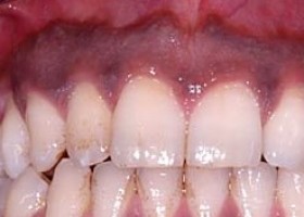 Periodontic Dentistry