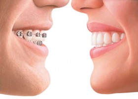 Orthodontics treatment in clinic