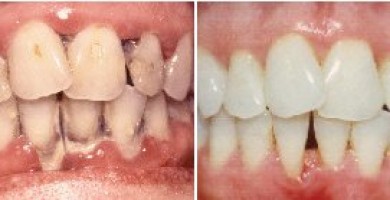 Periodontic Dentistry